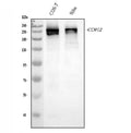 Anti-CHD2 Antibody Picoband®