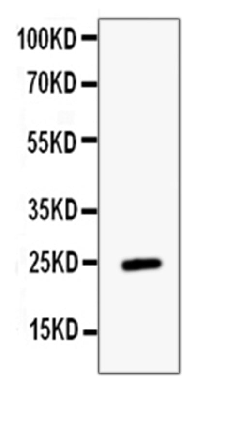 Anti-ESM1 Antibody Picoband®
