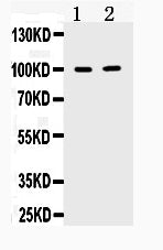 Anti-TACC1 Antibody Picoband®