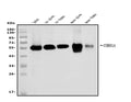 Anti-Coronin 1a/TACO/CORO1A Antibody Picoband®