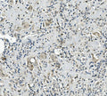 Anti-Calretinin/CALB2 Antibody Picoband®