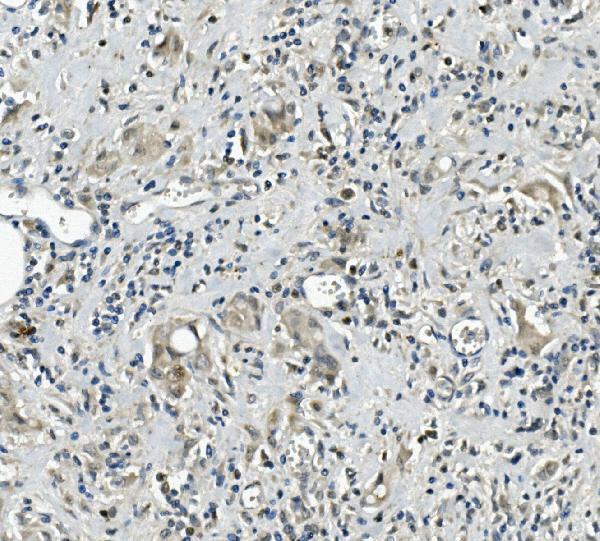 Anti-Calretinin/CALB2 Antibody Picoband®