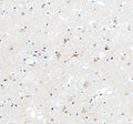Anti-ABI2 Antibody Picoband®