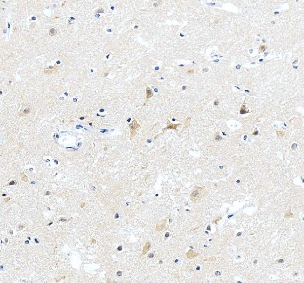 Anti-ABI2 Antibody Picoband®