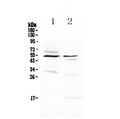 Anti-VIP Receptor 1/VIPR1 Antibody Picoband®