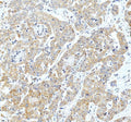 Anti-FACL4/ACSL4 Antibody Picoband®