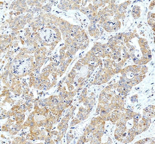 Anti-FACL4/ACSL4 Antibody Picoband®