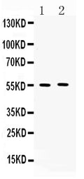 Anti-MMP11 Antibody Picoband®