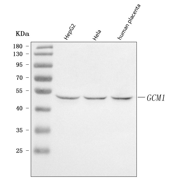 Anti-GCM1 Antibody Picoband®