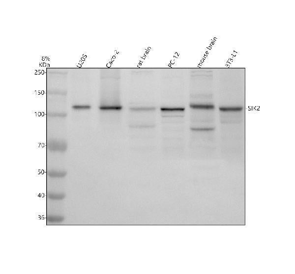 Anti-SIK2 Antibody Picoband®
