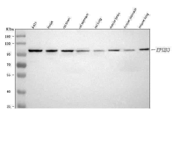 Anti-EPHB3 Antibody Picoband®