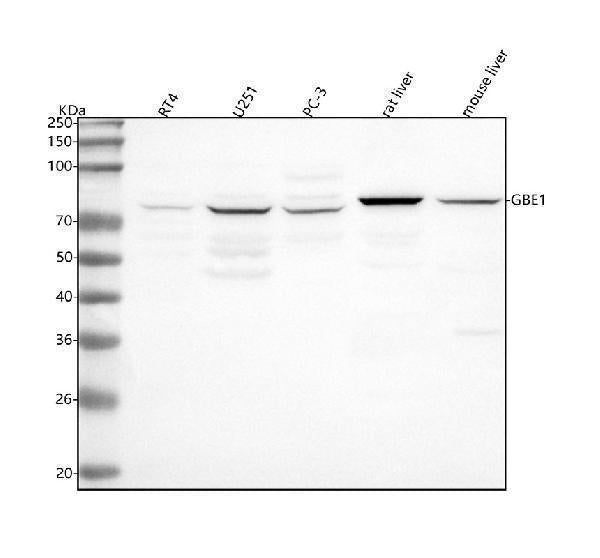 Anti-GBE1 Antibody Picoband®