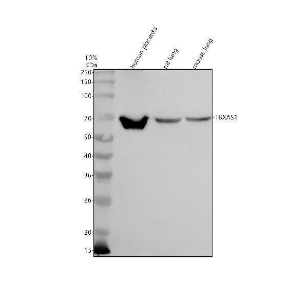 Anti-TBXAS1 Antibody Picoband®