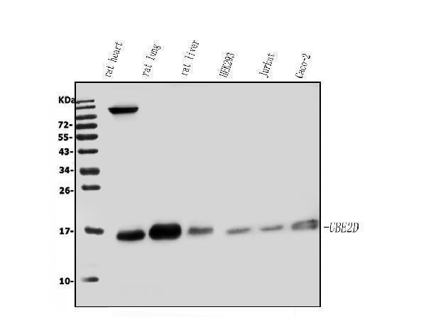 Anti-UBE2D1/2/3/4 Antibody Picoband®