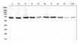 Anti-Hyaluronan synthase 1/HAS1 Antibody Picoband®