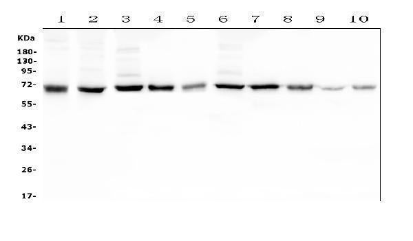 Anti-Hyaluronan synthase 1/HAS1 Antibody Picoband®