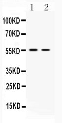 Anti-Vesicular Acetylcholine Transporter/SLC18A3 Antibody Picoband®