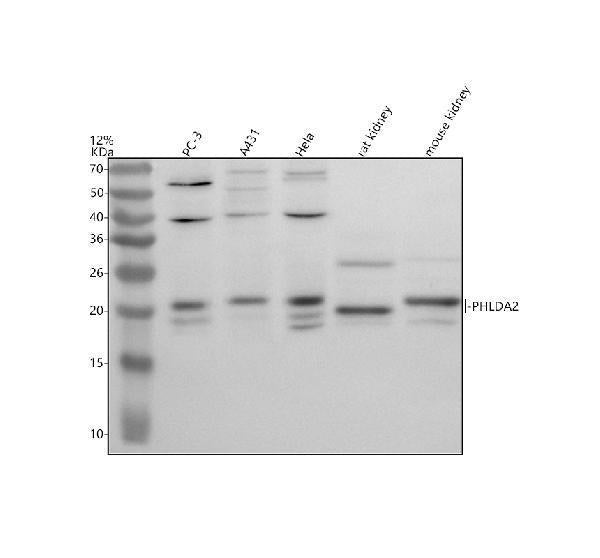 Anti-PHLDA2 Antibody Picoband®