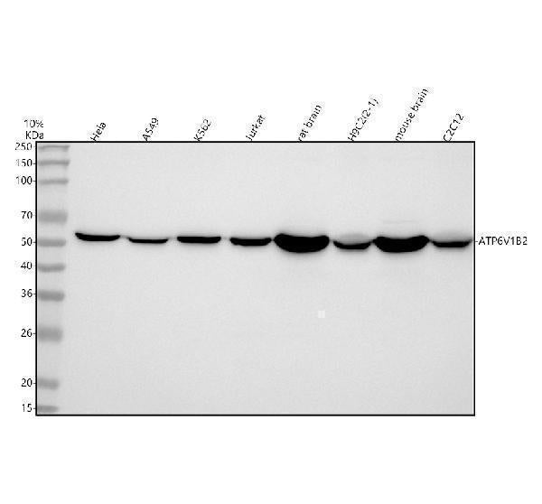 Anti-ATP6V1B2 Antibody Picoband®