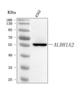 Anti-ALDH1A2 Antibody Picoband®