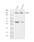 Anti-BRDT Antibody Picoband®