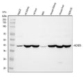 Anti-ACADS/SCAD Antibody Picoband®
