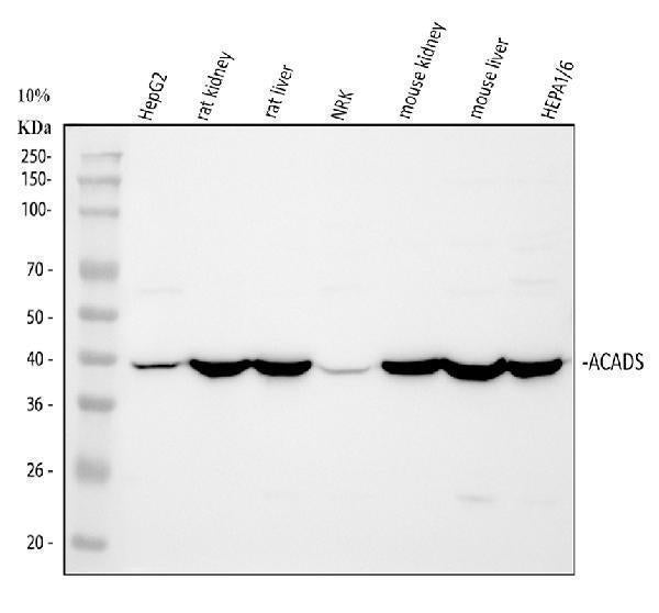 Anti-ACADS/SCAD Antibody Picoband®