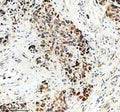 Anti-TCIRG1 Antibody