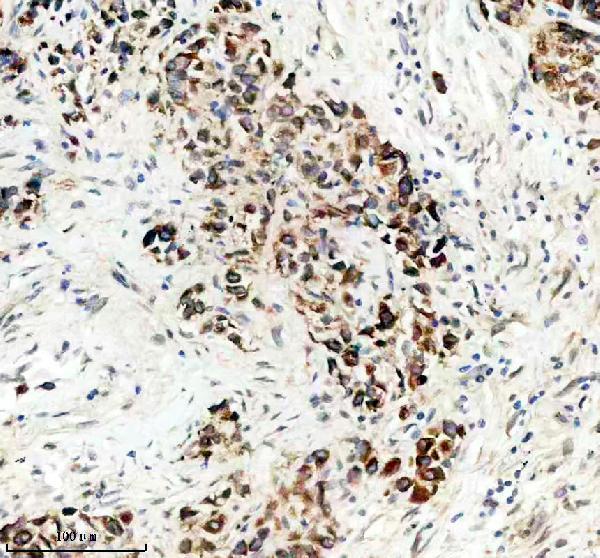 Anti-TCIRG1 Antibody