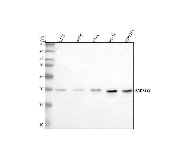 Anti-RARRES3/PLAAT4 Antibody Picoband®