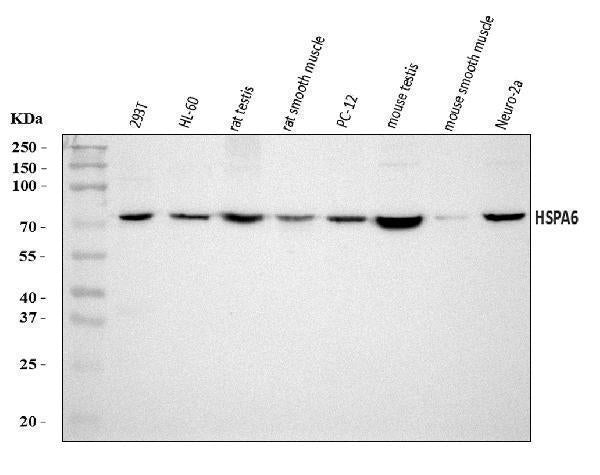 Anti-HSPA6 Antibody Picoband®
