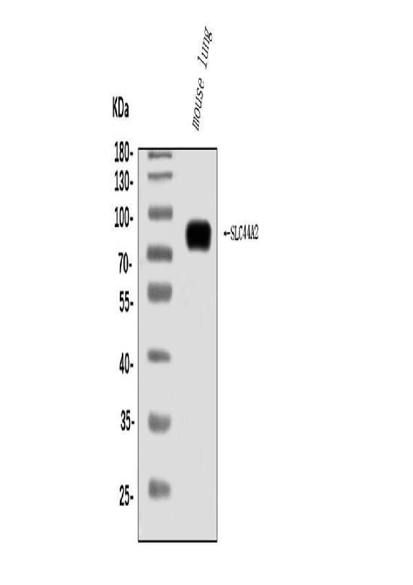 Anti-SLC44A2 Antibody Picoband®