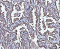 Anti-CCL15 Antibody