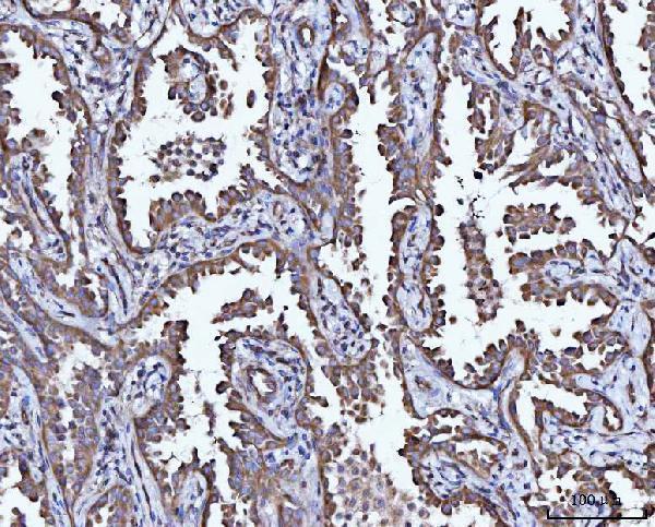 Anti-CCL15 Antibody