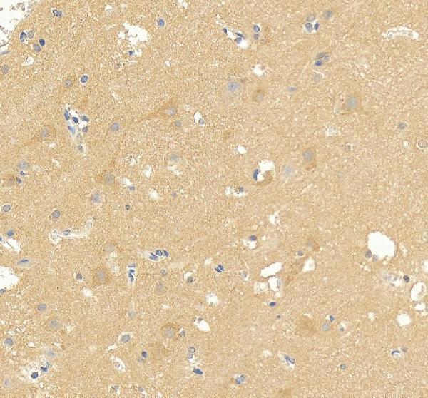 Anti-DNAJC6 Antibody Picoband®