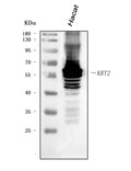 Anti-Cytokeratin 2e/KRT2 Antibody Picoband®