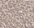 Anti-CCL23 Antibody