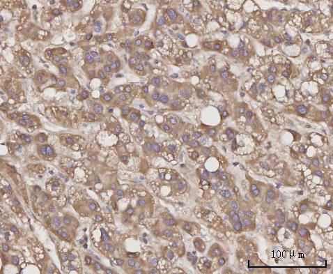 Anti-CCL23 Antibody