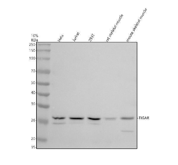 Anti-TIGAR Antibody Picoband®