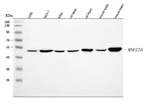 Anti-RNF216 Antibody Picoband®