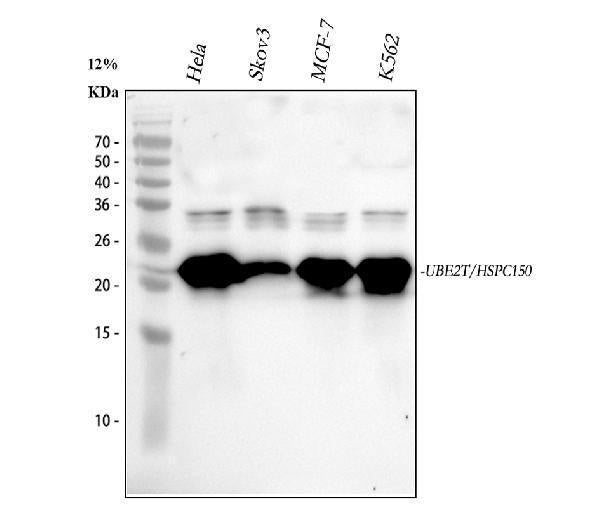 Anti-HSPC150/UBE2T Antibody Picoband®