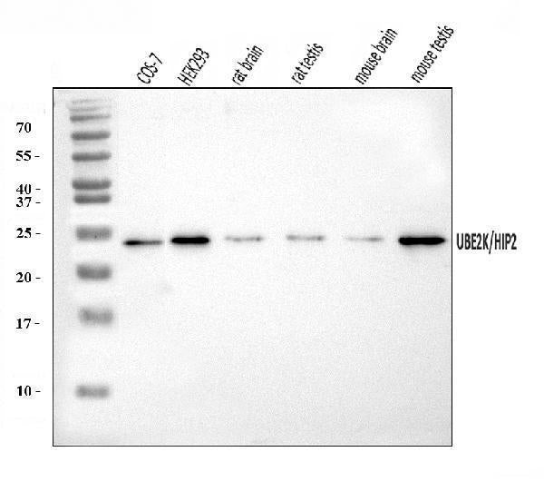 Anti-HIP2/LIG/UBE2K Antibody Picoband®