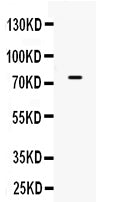 Anti-ACSL3 Antibody Picoband®