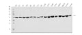 Anti-FABP-1/GOT2 Antibody Picoband®