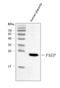 Anti-Glycodelin/PAEP Antibody Picoband®