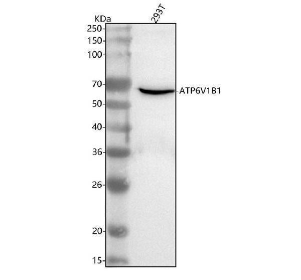 Anti-ATP6V1B1 Antibody Picoband®