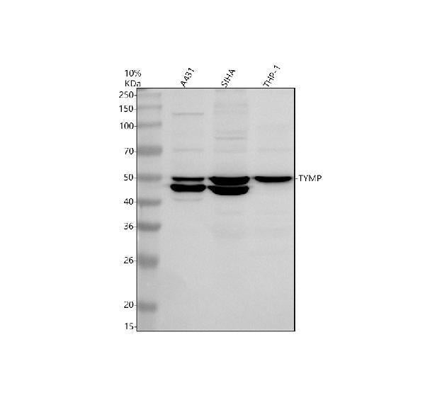 Anti-PD-ECGF/TYMP Antibody Picoband®