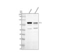 Anti-PFKL Antibody Picoband®
