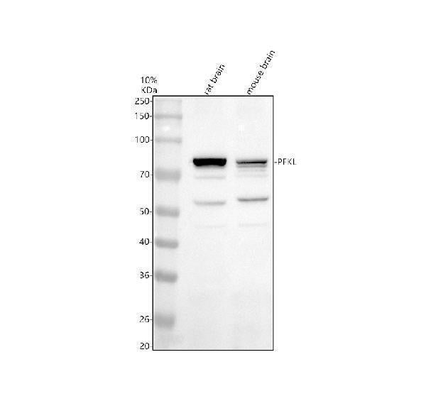 Anti-PFKL Antibody Picoband®