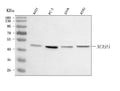 Anti-AADACL1/NCEH1 Antibody Picoband®